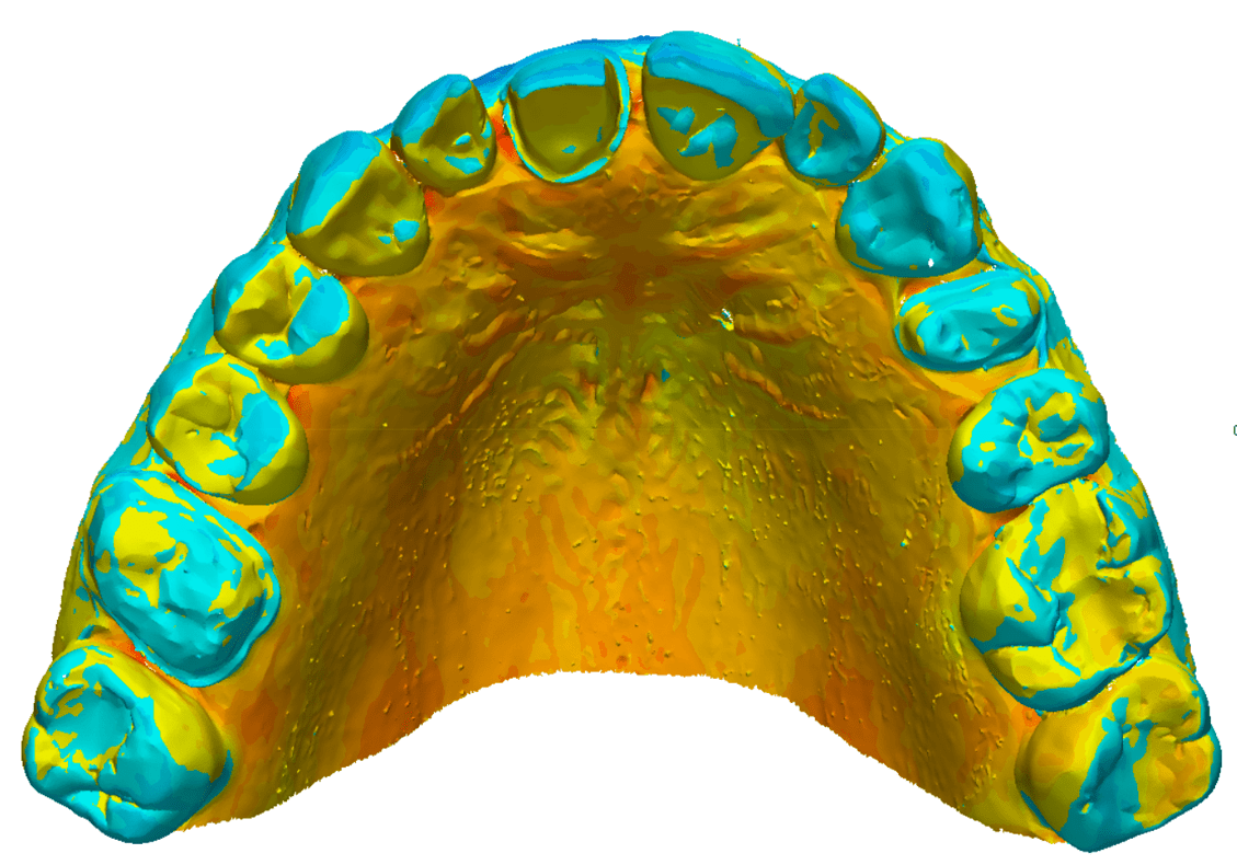 Digital Image of a Lower Jaw